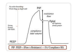 Ventilator-waveform-analysis_nagarjuna_2012.pdf