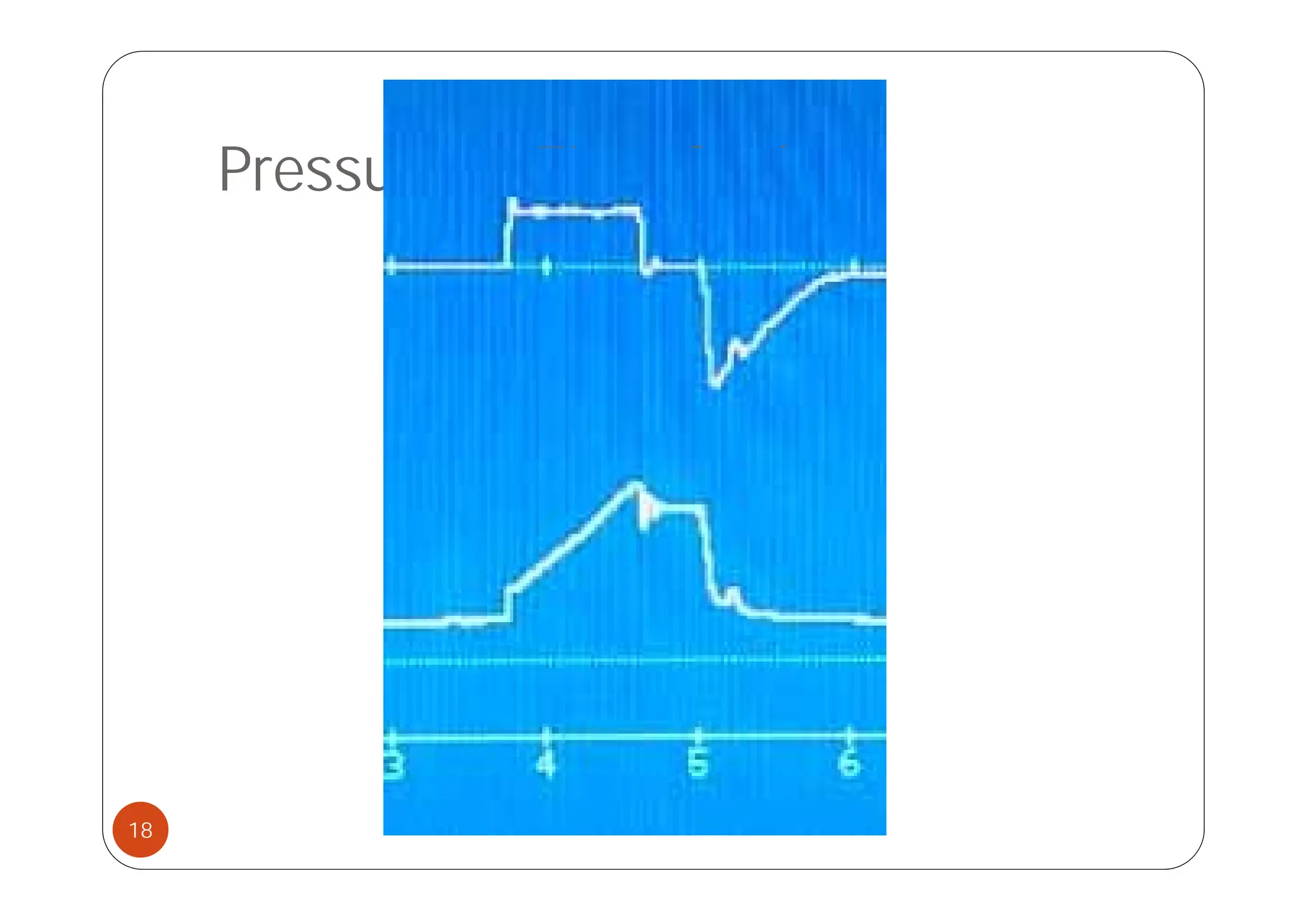 Pressure vs Time Scalar
18
 
