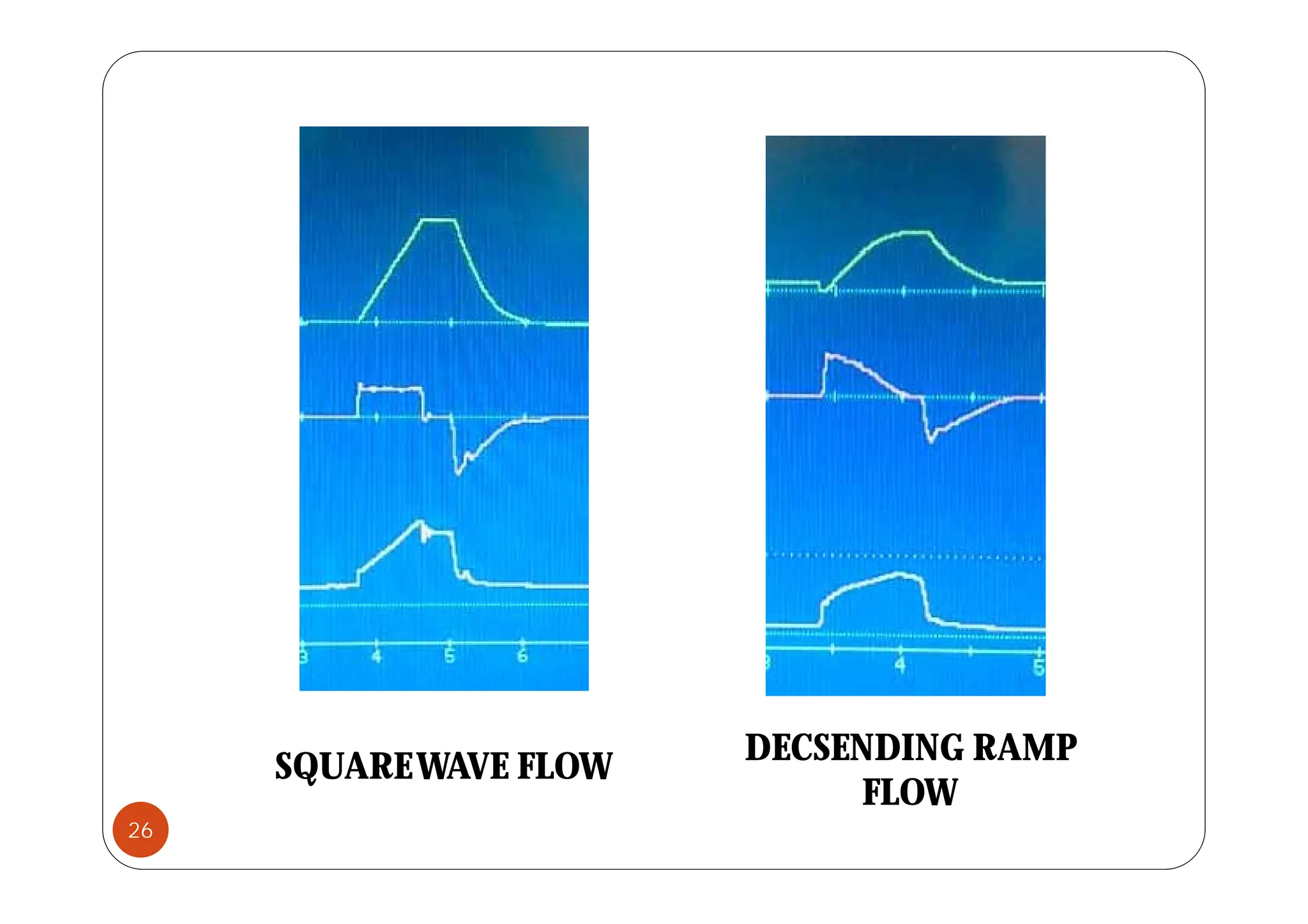 SQUAREWAVE FLOW
DECSENDING RAMP
26
SQUAREWAVE FLOW
FLOW
 
