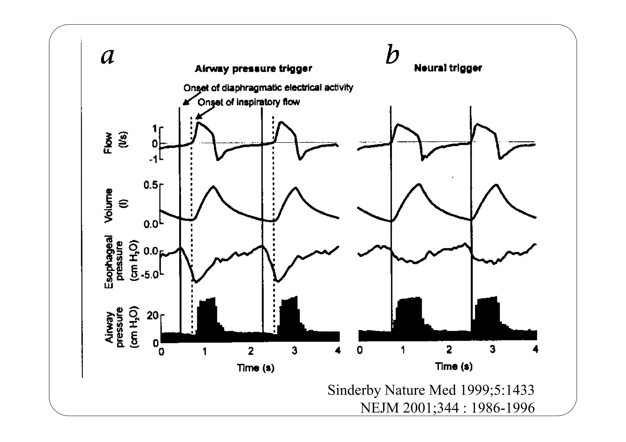 Sinderby Nature Med 1999;5:1433
NEJM 2001;344 : 1986-1996
 