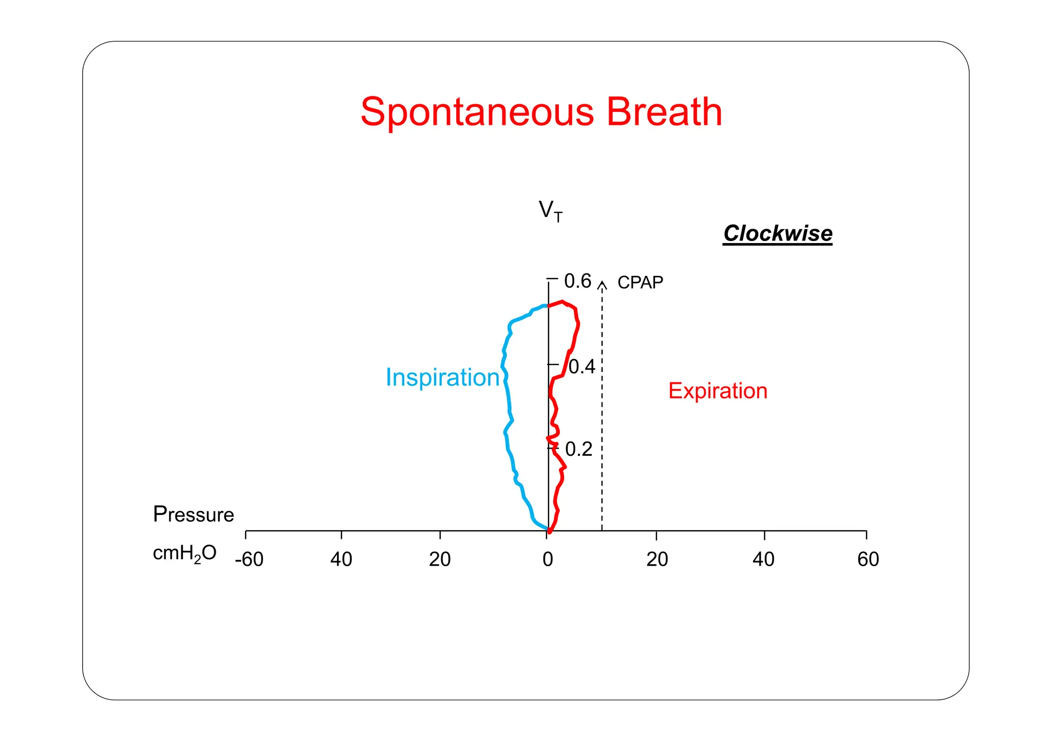 Spontaneous Breath
Spontaneous Breath
V
0.6
VT
Clockwise
CPAP
I i ti 0.4
0.6 CPAP
Inspiration
Expiration
0.2
0.4
Pressure
0 20 40 60
20
40
-60
cmH2O
 