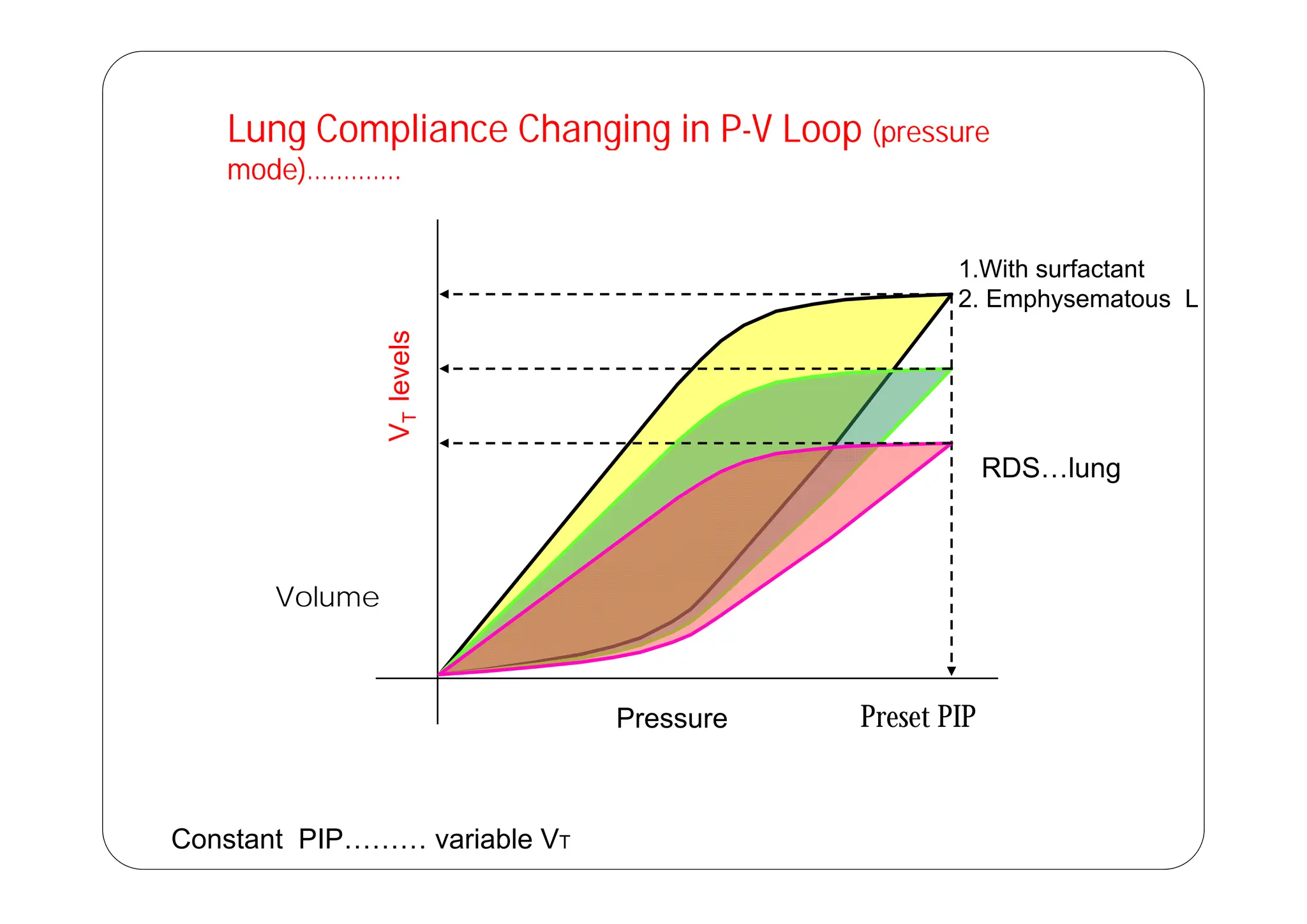 Lung Compliance Changing in P-V Loop (pressure
Lung Compliance Changing in P-V Loop (pressure
g p g g p
mode)………….
g p g g p
mode)………….
els
1.With surfactant
2. Emphysematous L
V
T
leve
RDS l
RDS…lung
Volume
Preset PIP
Pressure
Constant PIP……… variable VT
 