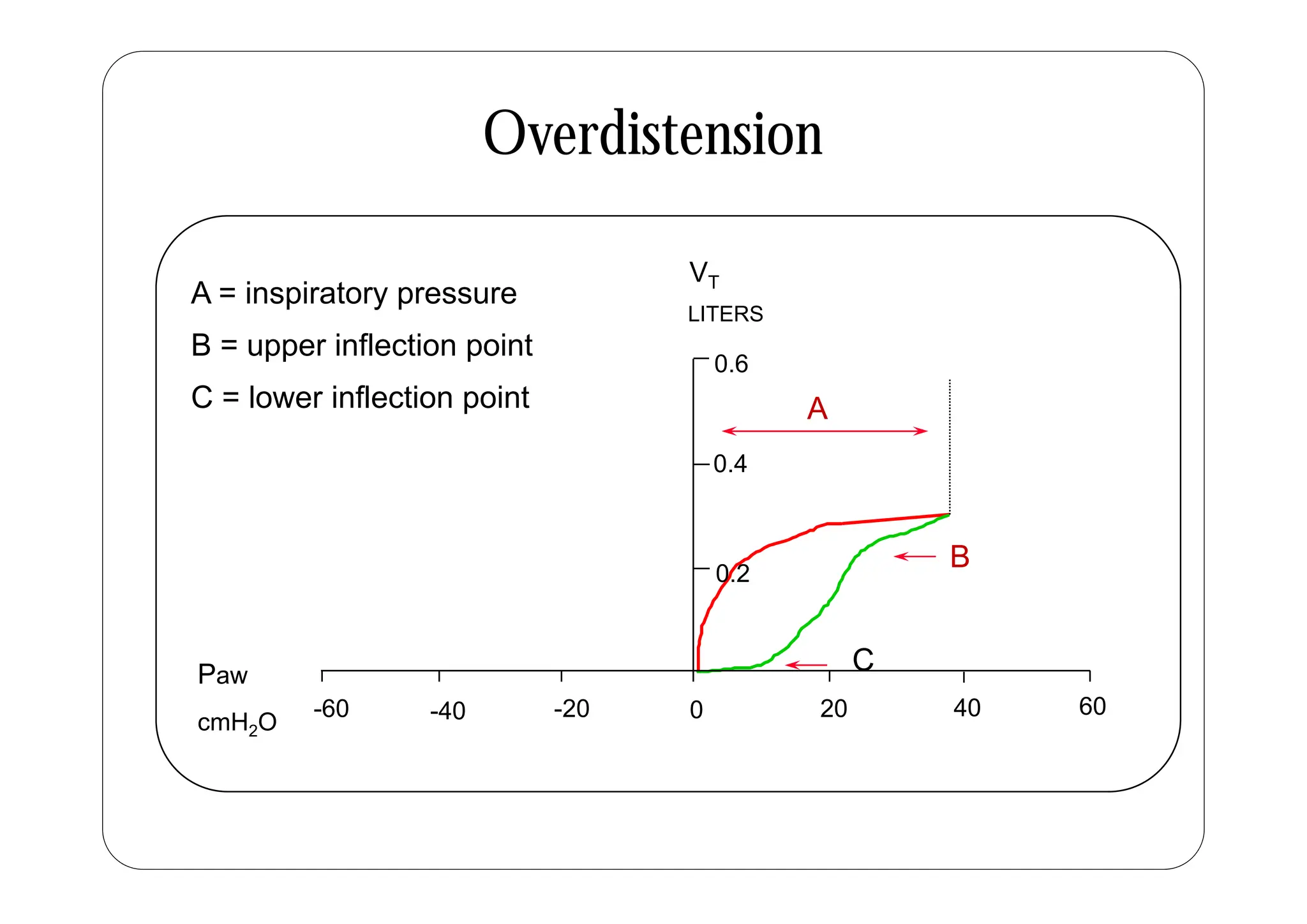Overdistension
Overdistension
0 6
LITERS
A = inspiratory pressure
B = upper inflection point
VT
A
0 4
0.6
pp p
C = lower inflection point
B
0 2
0.4
B
0.2
Paw
C
0 20 40 60
-20
-40
-60
Paw
cmH2O
 