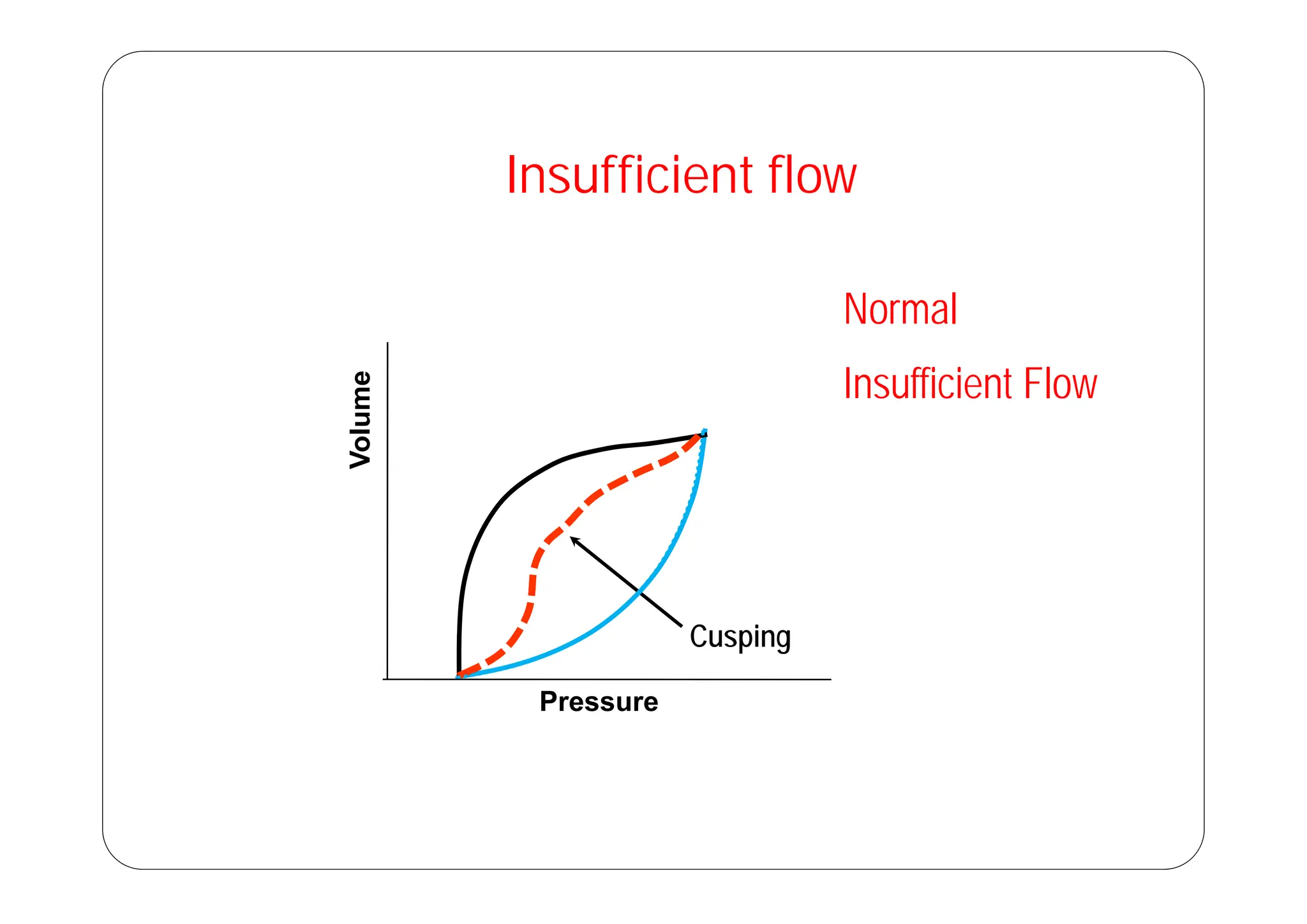 Insufficient flow
Normal
Volume
Insufficient Flow
V
Cusping
Pressure
 