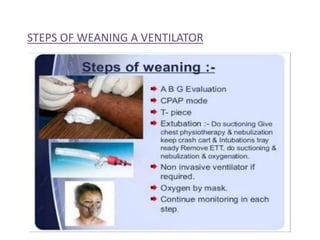 STEPS OF WEANING A VENTILATOR
 