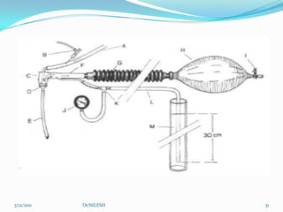 BUBBLE  CPAPFLOWMETERWATER5/20/2010Dr.NILESH29FLOW METER