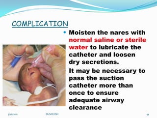 MONITORINGOnce NCPAP is applied, the infant’s condition must be monitored frequently