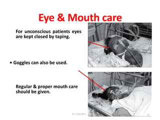 Eye & Mouth care
For unconscious patients eyes
are kept closed by taping.
• Goggles can also be used.
81
Regular & proper mouth care
should be given.
Dr.T.V.Rao MD ^
 