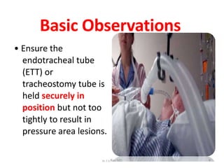 Basic Observations
• Ensure the
endotracheal tube
(ETT) or
tracheostomy tube is
held securely in
position but not too
tightly to result in
pressure area lesions.
Dr.T.V.
 