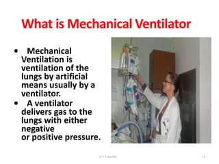 What is Mechanical Ventilator
• Mechanical
Ventilation is
ventilation of the
lungs by artificial
means usually by a
ventilator.
• A ventilator
delivers gas to the
lungs with either
negative
or positive pressure.
Dr.T.V.Rao MD 11
 