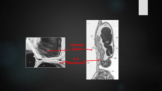 Alveolar
Space
A-C
Membrane
 