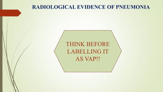 RADIOLOGICAL EVIDENCE OF PNEUMONIA
THINK BEFORE
LABELLING IT
AS VAP!!
 