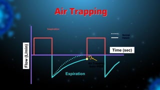 Air Trapping
Inspiration
Expiration
Normal
Patient
Time (sec)
Flow
(L/min)
Air Trapping
Auto-PEEP
}
 