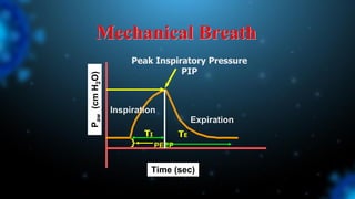 Mechanical Breath
Inspiration
Expiration
P
aw
(cm
H
2
O)
Time (sec)
}
TI
Peak Inspiratory Pressure
PIP
PEEP
TE
 