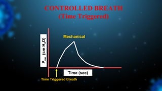 Mechanical
Time (sec)
P
aw
(cm
H
2
O)
Time Triggered Breath
CONTROLLED BREATH
(Time Triggered)
 