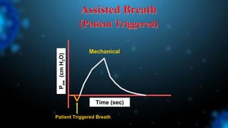 Assisted Breath
(Patient Triggered)
Mechanical
Time (sec)
P
aw
(cm
H
2
O)
Patient Triggered Breath
 