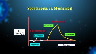Spontaneous vs. Mechanical
Mechanical
Time (sec)
Spontaneous
Paw
(cm H2O)
Inspiration
Expiration
Expiration
Inspiration
 
