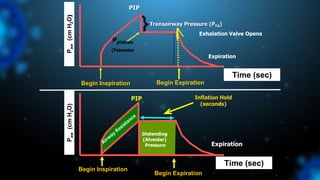 Begin Inspiration
Begin Expiration
P
aw
(cm
H
2
O)
Time (sec)
Distending
(Alveolar)
Pressure Expiration
Inflation Hold
(seconds)
Begin Expiration
P
aw
(cm
H
2
O)
Time (sec)
Begin Inspiration
PIP
Pplateau
(Palveolar
Transairway Pressure (PTA)
} Exhalation Valve Opens
Expiration
PIP
 