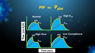 PIP vs Pplat
Normal High Raw
High Flow Low Compliance
Time (sec)
Paw
(cm
H
2
O)
PIP
PPlat
PIP
PIP PIP
PPlat
PPlat
PPlat
 