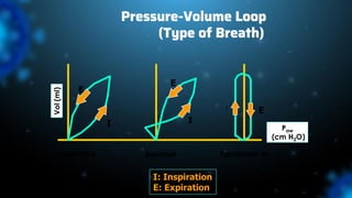 Pressure-Volume Loop
(Type of Breath)
Controlled Assisted Spontaneous
Vol
(ml)
Paw
(cm H2O)
I: Inspiration
E: Expiration
I
E
E
E
I
I
 