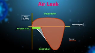 Air Leak
Inspiration
Expiration
Volume (ml)
Flow
(L/min)
Air Leak in mL
Normal
Abnormal
 