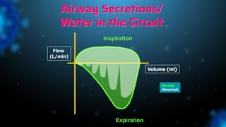 Airway Secretions/
Water in the Circuit
Inspiration
Expiration
Volume (ml)
Flow
(L/min)
Normal
Abnormal
 