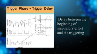Delay between the
beginning of
inspiratory effort
and the triggering
 