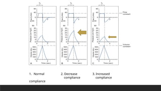 1. Normal
compliance
2. Decrease
compliance
3. Increased
compliance
 