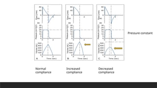 Pressure constant
Normal
compliance
Increased
compliance
Decreased
compliance
 