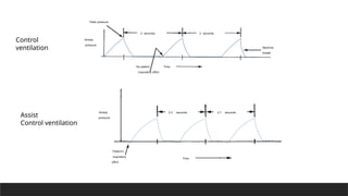 Peak pressure
3 seconds 3 seconds
Machine
breath
Time
No patient
inspiratory effort
Airway
pressure
2.5 seconds 2.7 seconds
Time
Airway
pressure
Patient’s
inspiratory
effort
Control
ventilation
Assist
Control ventilation
 