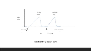 First breath
assisted
Second breath
control
Time
Machine-controlled breath
Patient-assisted
breath
Airway
pressure
Assist control pressure curve
 