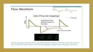 VENTILATOR basics with modes DR MANOJ.pptx