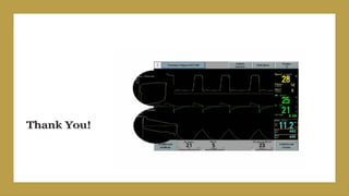 VENTILATOR basics with modes DR MANOJ.pptx