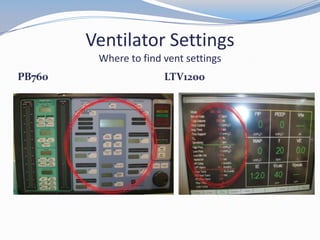 Ventilator Settings
Where to find vent settings
PB760 LTV1200
 