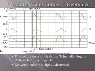  This condix has a much shorter Ti [not allowing for
Plateau] but for a longer Te
 Delivered volume is slightly decreased
 