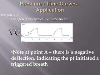 •Breath type
•Triggered Mechanical Volume Breath
•Note at point A – there is a negative
deflection, indicating the pt initiated a
triggered breath
 