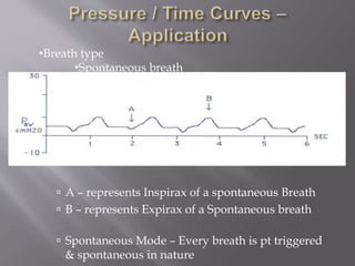  A – represents Inspirax of a spontaneous Breath
 B – represents Expirax of a Spontaneous breath
 Spontaneous Mode – Every breath is pt triggered
& spontaneous in nature
•Breath type
•Spontaneous breath
 