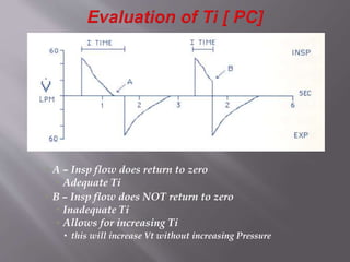 A – Insp flow does return to zero
 Adequate Ti
 B – Insp flow does NOT return to zero
 Inadequate Ti
 Allows for increasing Ti
 this will increase Vt without increasing Pressure
 