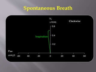 Spontaneous Breath
Inspiration
0 20 40 602040-60
0.2
LITERS
0.4
0.6
Paw
cmH2O
VT
Clockwise
 
