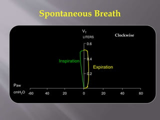 Spontaneous Breath
Inspiration
Expiration
0 20 40 602040-60
0.2
LITERS
0.4
0.6
Paw
cmH2O
VT
Clockwise
 