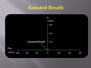 Assisted Breath
0 20 40 602040-60
0.2
LITERS
0.4
0.6
Paw
cmH2O
Assisted Breath
VT
 