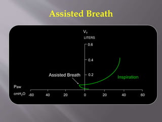 Assisted Breath
Inspiration
0 20 40 602040-60
0.2
LITERS
0.4
0.6
Paw
cmH2O
Assisted Breath
VT
 