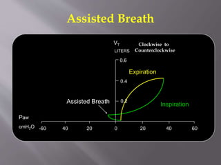 Assisted Breath
Inspiration
Expiration
0 20 40 602040-60
0.2
LITERS
0.4
0.6
Paw
cmH2O
Assisted Breath
VT Clockwise to
Counterclockwise
 