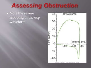  Note the severe
scooping of the exp
waveform
 