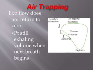 Exp flow does
not return to
zero
Pt still
exhaling
volume when
next breath
begins
 