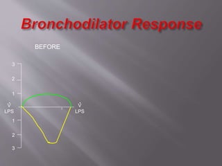 2
1
1
2
3
3
V
LPS
.
BEFORE
V
LPS
.
 