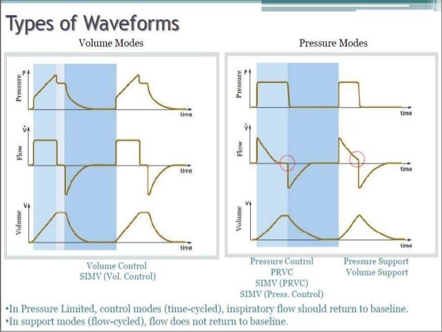 Ventilator graphics
