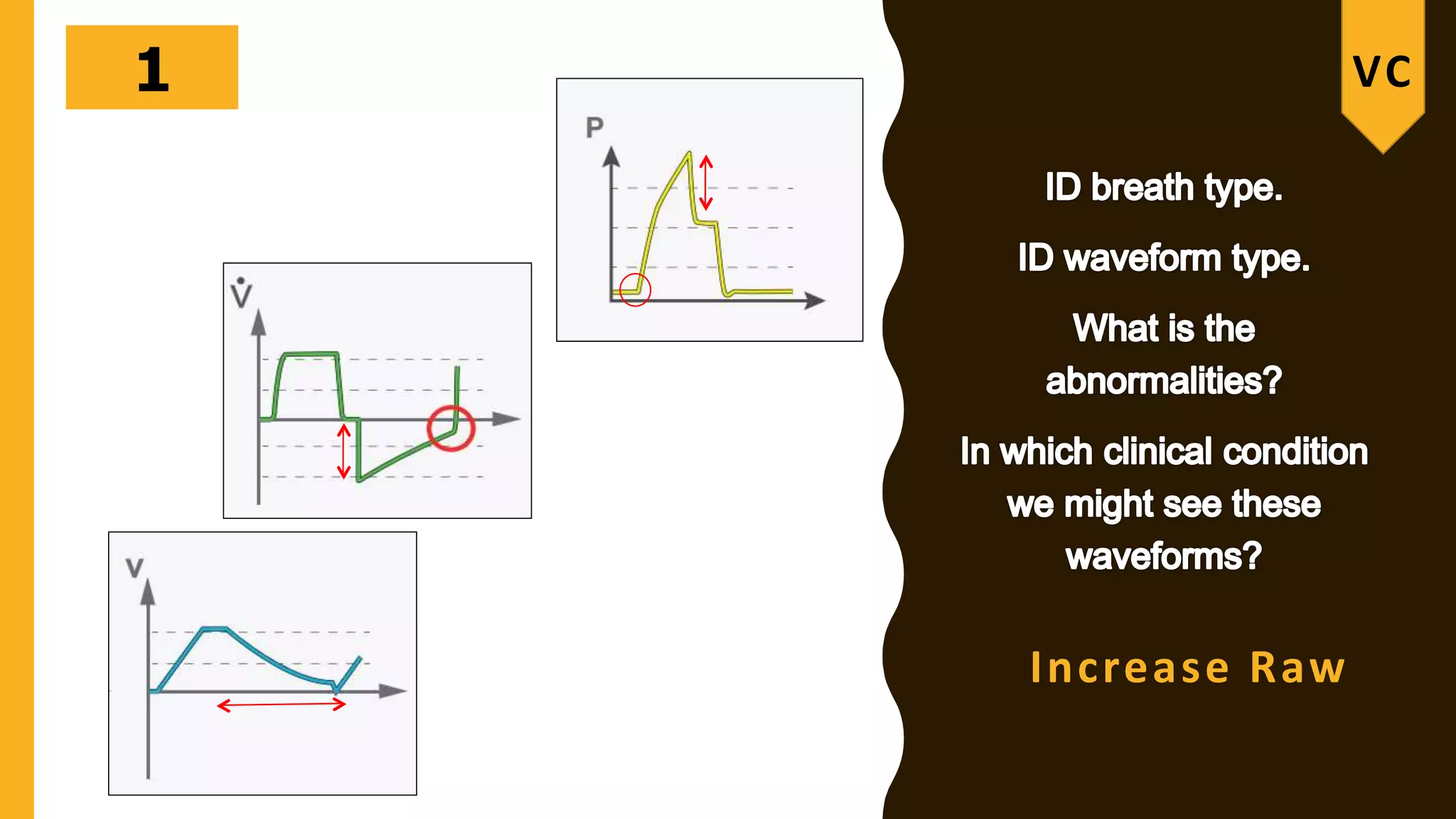 Ventilator graphics PPT