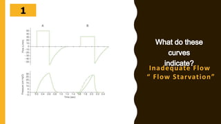 302928272625242322212019181716151413121110987654321
Inadequate Flow
“ Flow Starvation”
 