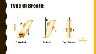 Type Of Breath:
Controlled Assisted Spontaneous
I
E
E
E
I
IPEEP
 
